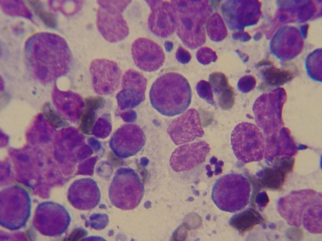 Células afetadas por linfoma em um Golden Retriever