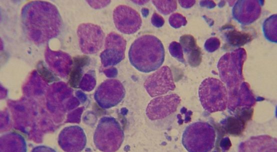 Células afetadas por linfoma em um Golden Retriever